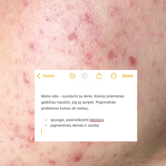 Klientės krepšelio pokytis