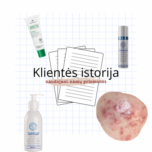 Klientės istorija