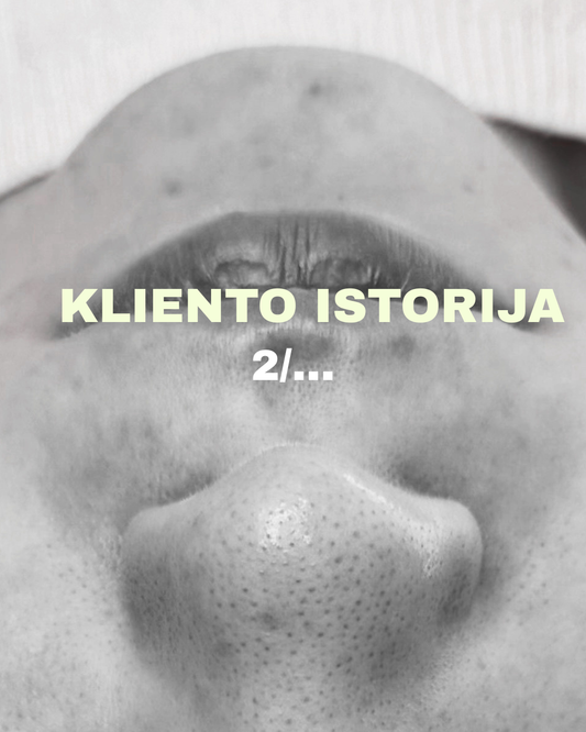 Kliento istorija 2/…
